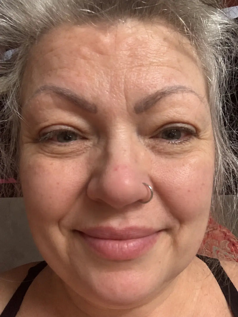 Linda, 59 — after
