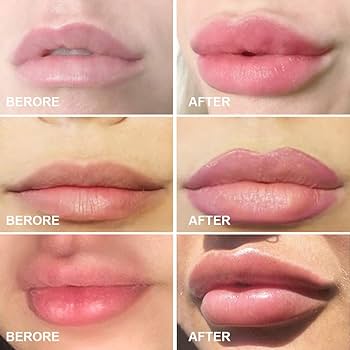 JoliTape - Hydrating Collagen Mouth Tape