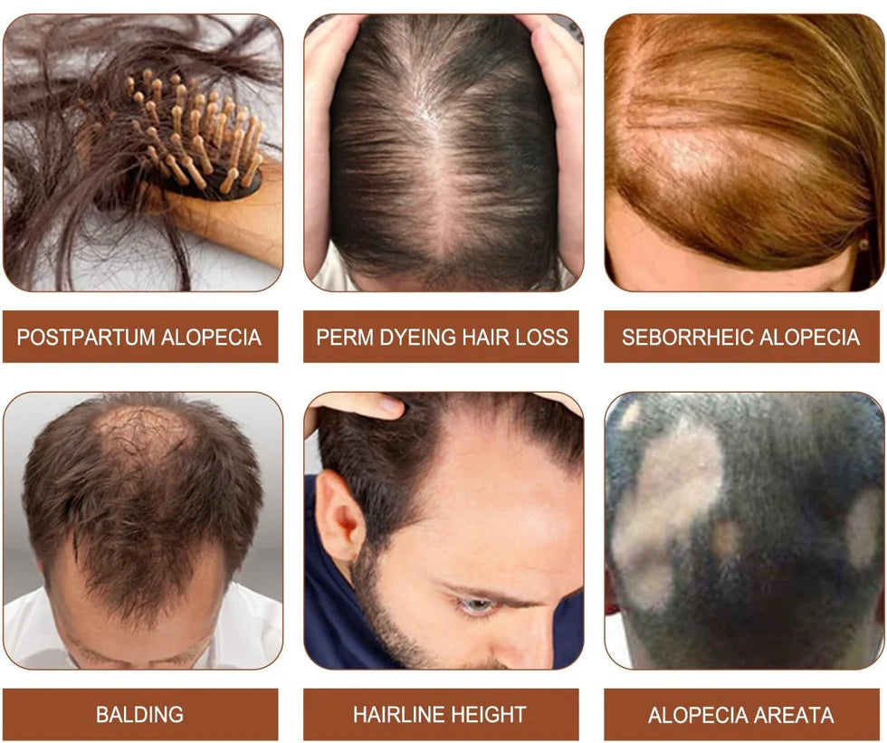 Batana Fortifying Oil Intense Hair Care