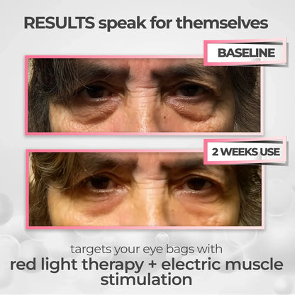LiftEyes™ Pro