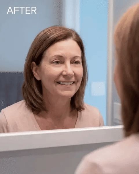 Susan, 58 — after