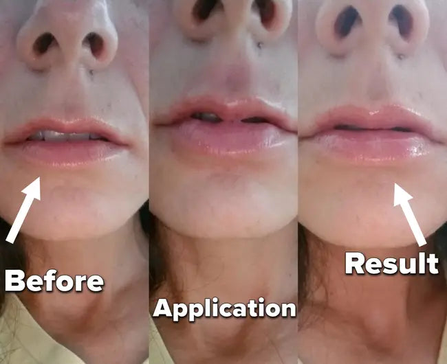 JoliTape - Hydrating Collagen Mouth Tape
