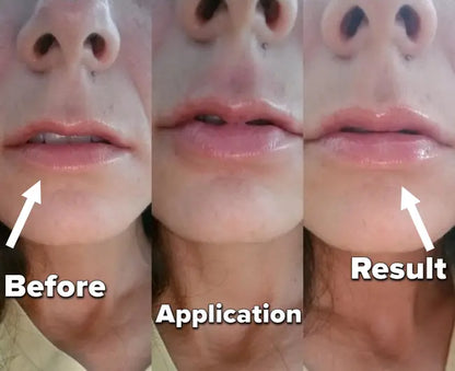 JoliTape - Hydrating Collagen Mouth Tape